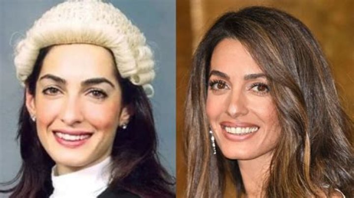 Amal Clooney's Transformation Before Surgery