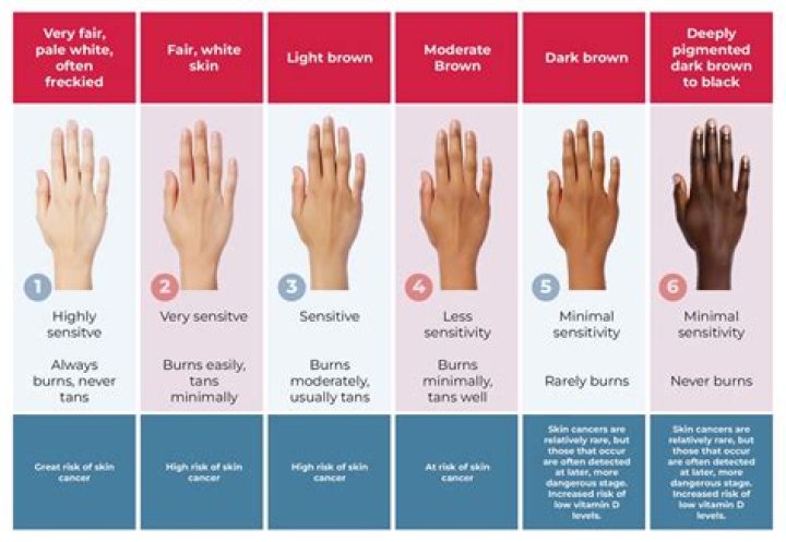 Can Black Skin Get Sunburn? Understanding Skin Protection for Darker Skin Tones