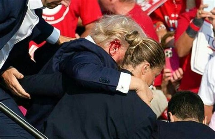Trump Ear Surgery: Understanding the Controversy and Its Implications