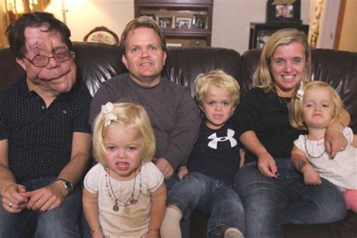 Understanding Adam Pearson's Personal Life: Who is His Wife?