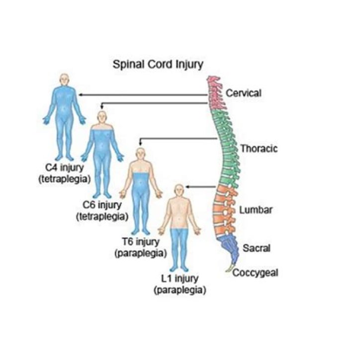 Understanding Harriet Robson's Injuries: A Comprehensive Overview