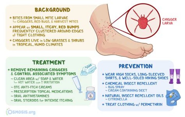 Understanding Jiggers in Feet: Causes, Prevention, and Treatment